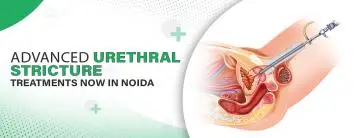 Advanced Urethral Stricture Treatments Now in Noida