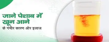 जाने पेशाब में खून आने के गंभीर कारण और इलाज