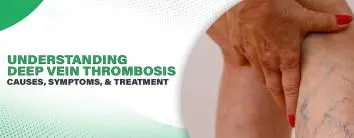 Deep Vein Thrombosis