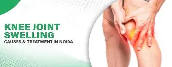 Knee Joint Swelling – Causes and Treatment In Noida