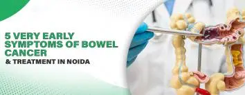 5 Very Early Symptoms of Bowel Cancer and Treatment in Noida