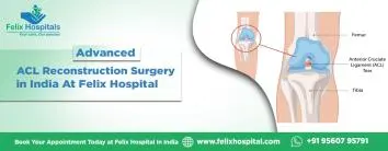 Advanced ACL Reconstruction Surgery in India At Felix Hospital