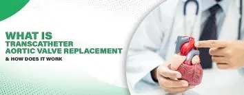 Transcatheter Aortic Valve Replacement (TAVR)