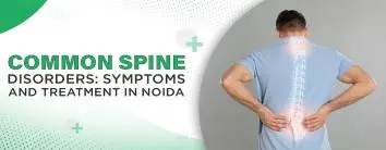 Common Spine Disorders: Symptoms and Treatment in Noida