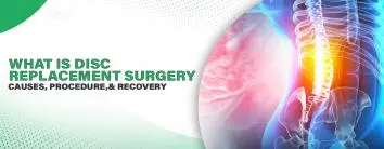 What is Disc Replacement Surgery? Causes, Procedure, and Recovery