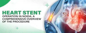 Heart Stent Operation In Noida