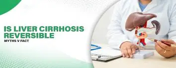 Is Liver Cirrhosis Reversible? Myths versus Facts