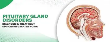 Pituitary Gland Disorders