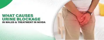 What Causes Urine Blockage in Males and Treatment in Noida?