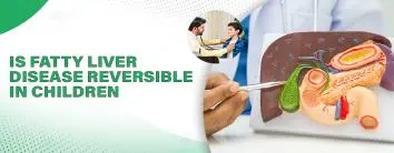 Is fatty liver disease reversible