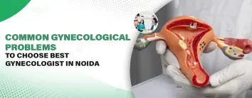 Common Gynecological Problems