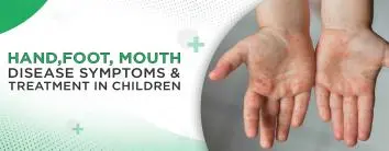 Hand, Foot, and Mouth Disease in Children