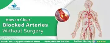 Clear Blocked Arteries Without Surgery