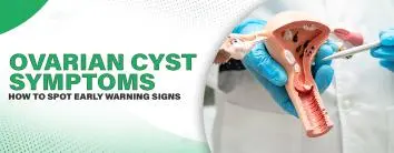 Ovarian Cyst Symptoms