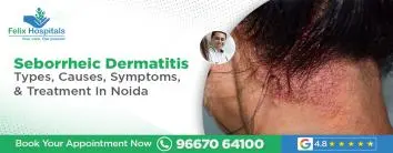 Seborrheic Dermatitis 