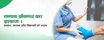 तनाव फ्रैक्चर का इलाज