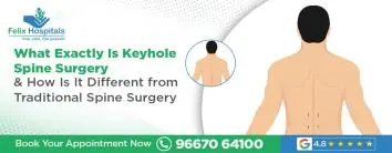 What Exactly Is Keyhole Spine Surgery