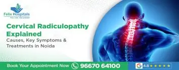 Cervical Radiculopathy Explained
