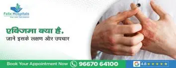 एक्जिमा क्या है, जानें इसके लक्षण और उपचार