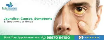 Jaundice: Causes, Symptoms & Treatment in Noida