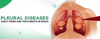 Pleural Diseases