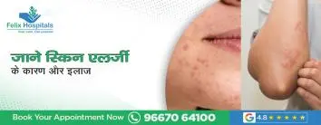 जाने त्वचा एलर्जी (Skin Allergy) के कारण और इलाज