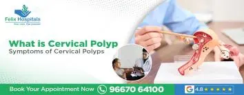 What is Cervical Polyp: Symptoms of Cervical Polyps