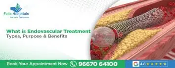 Endovascular Treatment In Noida