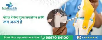 नोएडा में बेस्ट घुटना प्रत्यारोपण सर्जरी: कब जरूरी है?