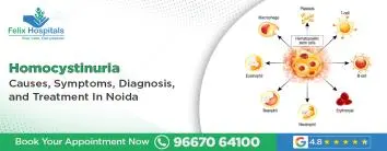 Homocystinuria: Causes, Symptoms, Diagnosis, and Treatment in Noida