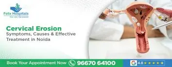 Cervical Erosion Symptoms, Causes & Effective Treatment in Noida