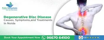 Degenerative Disc Disease: Causes, Symptoms, and Treatments In Noida
