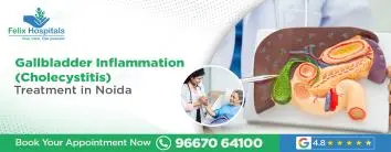 Gallbladder Inflammation (Cholecystitis) Treatment in Noida