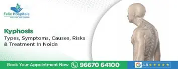 Kyphosis: Types, Symptoms, Causes, Risks & Treatment in Noida