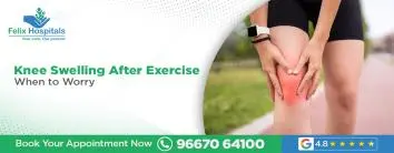 Knee Swelling After Exercise: When to Worry
