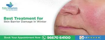 Best Treatment for Skin Barrier Damage in Winter
