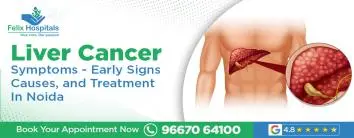 Liver Cancer Symptoms