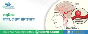 एन्यूरिज्म: प्रकार, लक्षण और इलाज