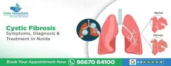 Cystic Fibrosis: Symptoms, Diagnosis & Treatment In Noida