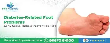 Diabetes-Related Foot Problems