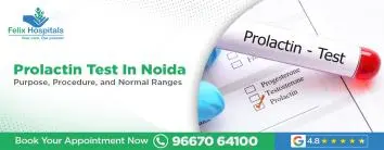 Prolactin Test In Noida