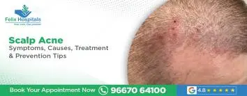 Scalp Acne
