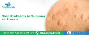 Skin Problems in Summer and Prevention