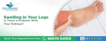 Swelling in Your Legs – Is There a Problem With Your Kidneys?