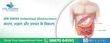 आंत्र रुकावट (Intestinal Obstruction): कारण, लक्षण और उपचार के विकल्प