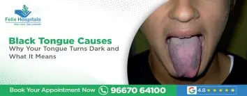 Black Tongue Causes