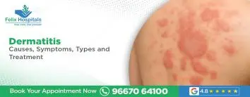 Dermatitis