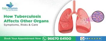 How Tuberculosis Affects Other Organs