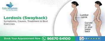 Lordosis (Swayback)