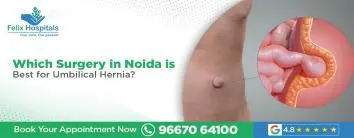 Which Surgery in Noida is Best for Umbilical Hernia